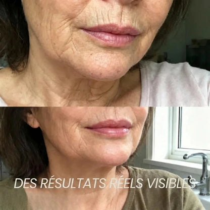 STICK REPULPANT  BIO-COLLAGÈNE VOLUFILINE®